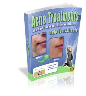 Acne Treatments